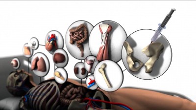 Jól működik a transzplantációs figyelő szolgálat